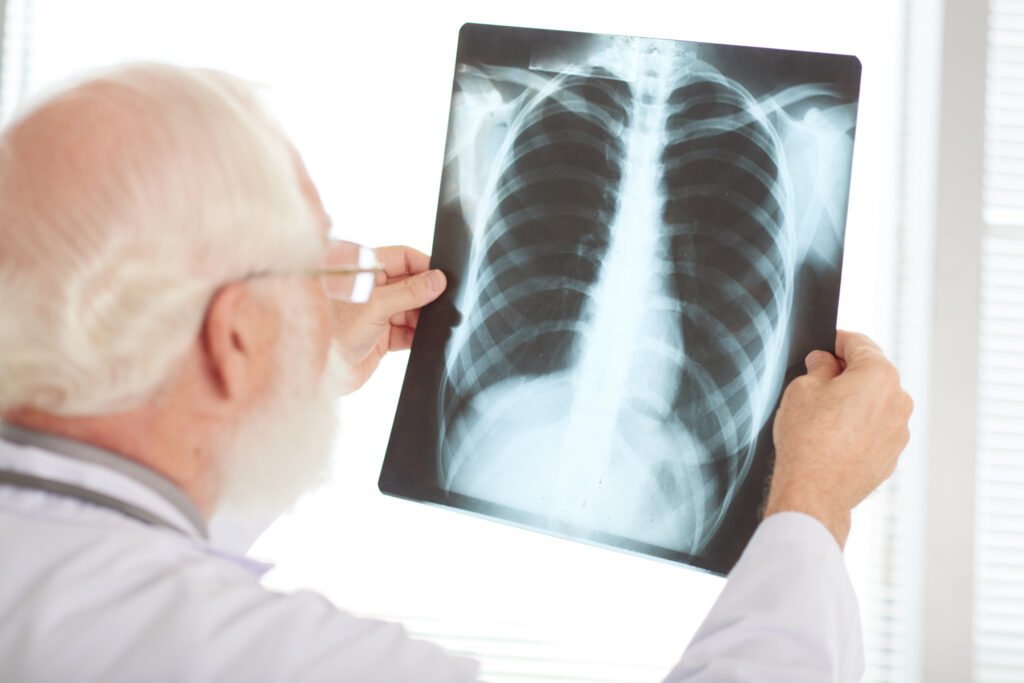 TB Research May Transform Inflammatory Disorder Treatments